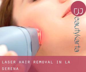 Laser Hair removal in La Serena