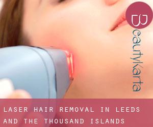 Laser Hair removal in Leeds and the Thousand Islands