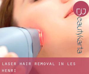 Laser Hair removal in Les Henri