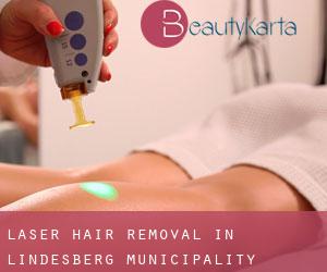 Laser Hair removal in Lindesberg Municipality
