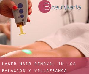 Laser Hair removal in Los Palacios y Villafranca