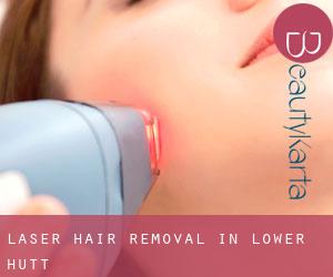 Laser Hair removal in Lower Hutt