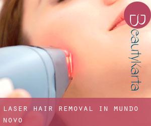 Laser Hair removal in Mundo Novo