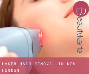 Laser Hair removal in New London