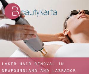 Laser Hair removal in Newfoundland and Labrador