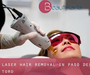 Laser Hair removal in Paso del Toro