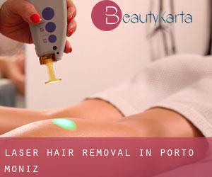 Laser Hair removal in Porto Moniz