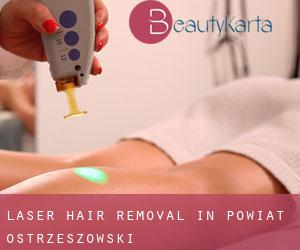 Laser Hair removal in Powiat ostrzeszowski