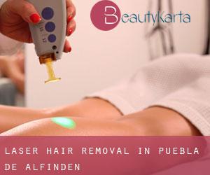 Laser Hair removal in Puebla de Alfindén