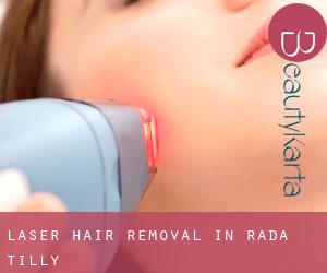 Laser Hair removal in Rada Tilly