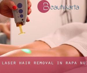 Laser Hair removal in Rapa Nui