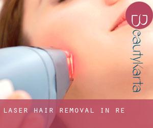 Laser Hair removal in Re