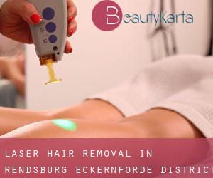 Laser Hair removal in Rendsburg-Eckernförde District
