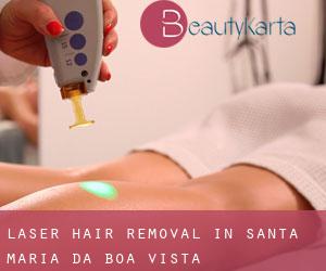 Laser Hair removal in Santa Maria da Boa Vista