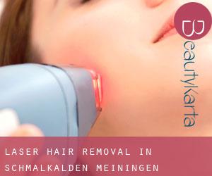 Laser Hair removal in Schmalkalden-Meiningen Landkreis