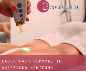 Laser Hair removal in Skarżysko-Kamienna