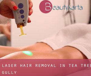 Laser Hair removal in Tea Tree Gully