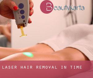 Laser Hair removal in Time
