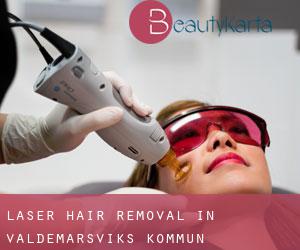 Laser Hair removal in Valdemarsviks Kommun