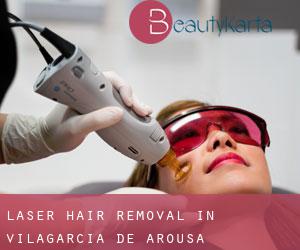 Laser Hair removal in Vilagarcía de Arousa