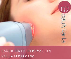 Laser Hair removal in Villasarracino