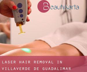 Laser Hair removal in Villaverde de Guadalimar