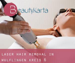 Laser Hair removal in Wülflingen (Kreis 6)