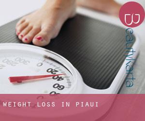 Weight Loss in Piauí Weight Loss in Piauí