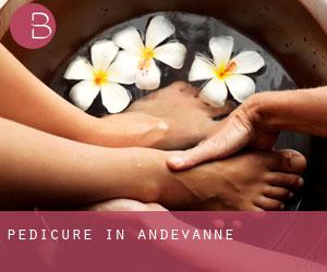 Pedicure in Andevanne