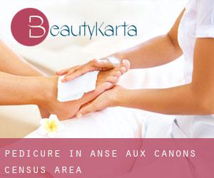 Pedicure in Anse-aux-Canons (census area)